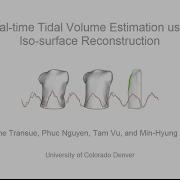 Real Time Tidal Volume Estimation Using Iso Surface Reconstruction