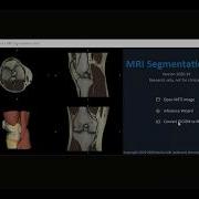 DICOM NIFTI Conversion