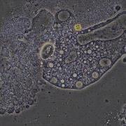 Germ Vs Soap What Happens When We Wash Hands Microscope Footage