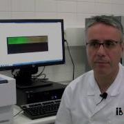 Array CGH Descubriendo Los Milagros Del Embrión Comprehensive Chromosome Screening CCS