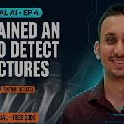 I Trained An AI To Detect Bone Fractures Full Tutorial Free Code YOLO11