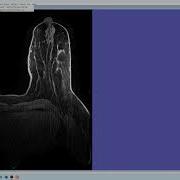 AI Deep Learning FastMRI Breast Segmentation In FireVoxel