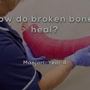 How Do Broken Bones Heal