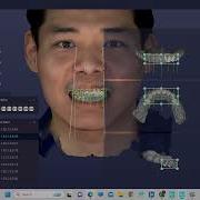 Medit Import Ray Face Scan Data And Smile Design
