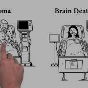 How Is Brain Death Different Than Coma