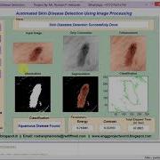 Skin Disease Detection Using Image Processing Matlab Project Code