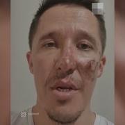 Выживший на Эльбрусе бросил предъяву спасателям