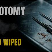 The Surgery That Turned Humans Into Zombies History Of Lobotomy History For Sleep