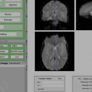 SPM Tutorial 3 Looking At The Data