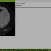 Ver Imagen Dicom Usando Vtk Y Simpleitk En Python