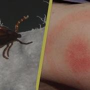 What Bit Me Spot The Difference Between A Spider Tick Or Mosquito Bite Health And Weather